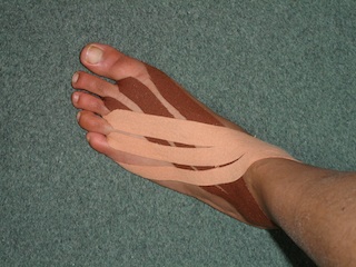 Kinesiotape