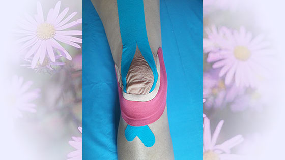 kinesiotape