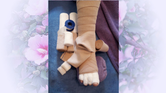 Compression Hoisery